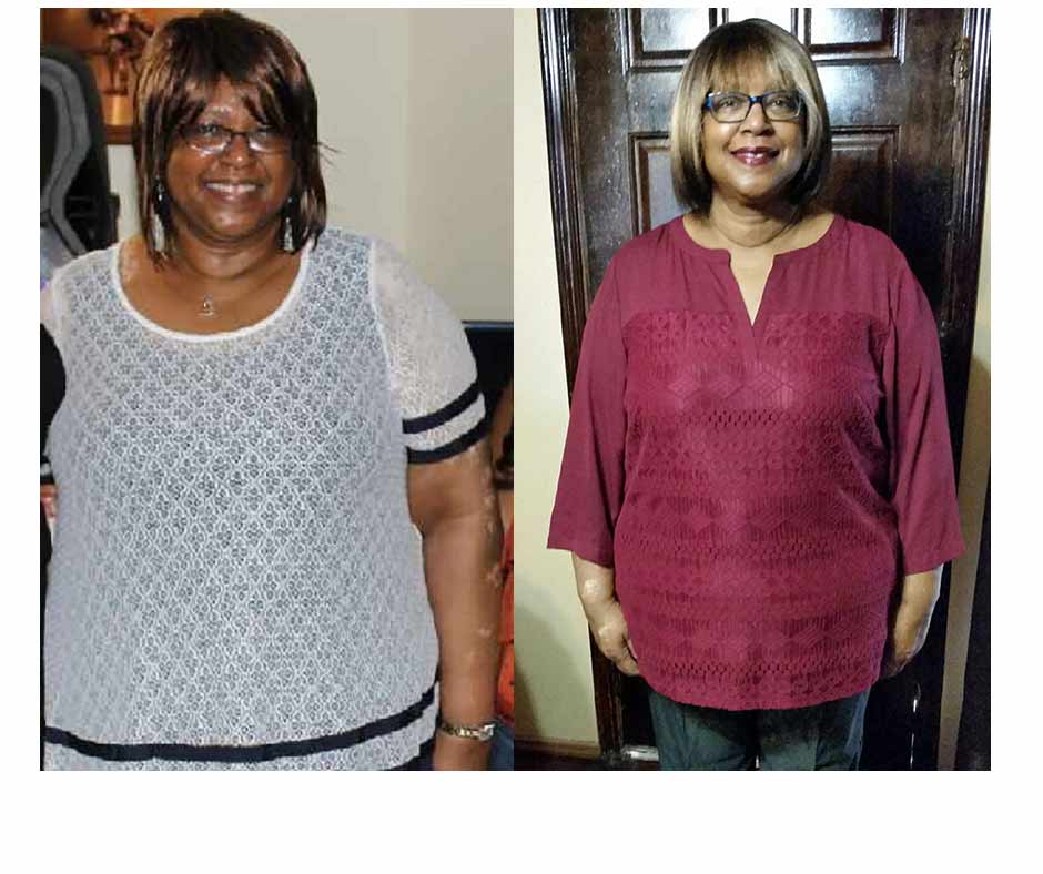 Barbara lose weight after 60